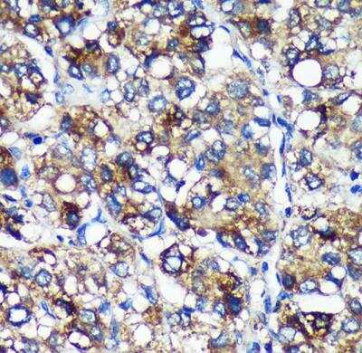 Immunohistochemistry-Paraffin: PYCR2 Antibody - Azide and BSA Free [NBP2-93882]