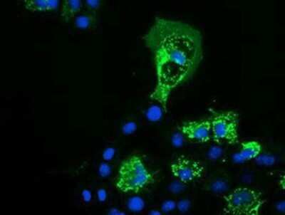 Immunocytochemistry/ Immunofluorescence: PYCR2 Antibody (OTI3D1) - Azide and BSA Free [NBP2-73743]