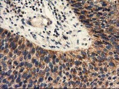 Immunohistochemistry: PYCR2 Antibody (OTI3D1) - Azide and BSA Free [NBP2-73743]