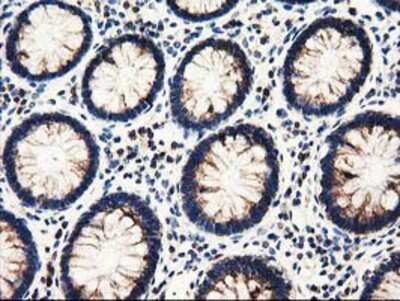 Immunohistochemistry: PYCR2 Antibody (OTI3D1) - Azide and BSA Free [NBP2-73743]