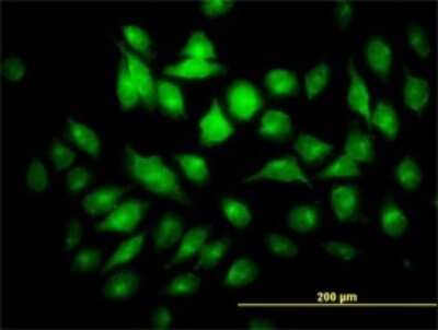 Immunocytochemistry/ Immunofluorescence: PYCRL Antibody (4F11) [H00065263-M01]