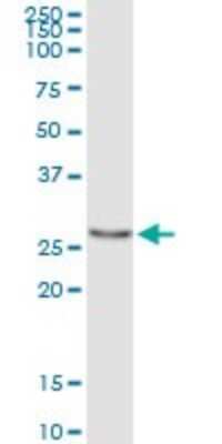 Immunoprecipitation: PYCRL Antibody (4F11) [H00065263-M01]