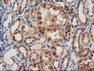Immunohistochemistry: PYCRL Antibody (OTI1B12) - Azide and BSA Free [NBP2-73752]