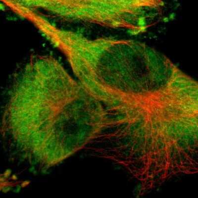 Immunocytochemistry/ Immunofluorescence: PYGL Antibody [NBP1-86182]