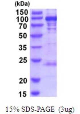 SDS-PAGE: Recombinant Human PYGL His Protein [NBP2-52066]