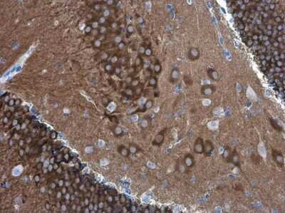 Immunohistochemistry-Paraffin: PYK2/FAK2 Antibody (GT1132) [NBP3-13573]