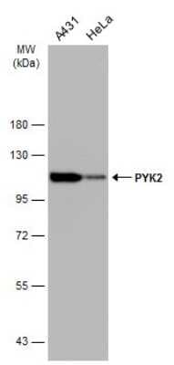 Western Blot: PYK2/FAK2 Antibody (GT858) [NBP3-13592]