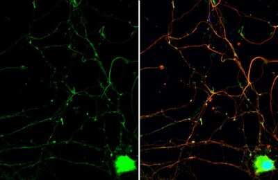 Immunocytochemistry/ Immunofluorescence: PYK2/FAK2 Antibody [NBP3-12969]