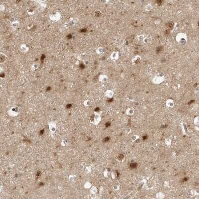 Immunohistochemistry-Paraffin: PYK2/FAK2 Antibody [NBP1-91228]