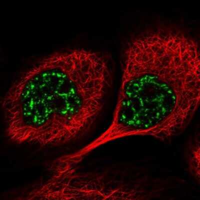 Immunocytochemistry/ Immunofluorescence: PYROXD1 Antibody [NBP2-38404]