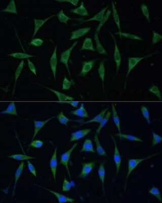Immunocytochemistry/ Immunofluorescence: Paladin Antibody - Azide and BSA Free [NBP2-93550]