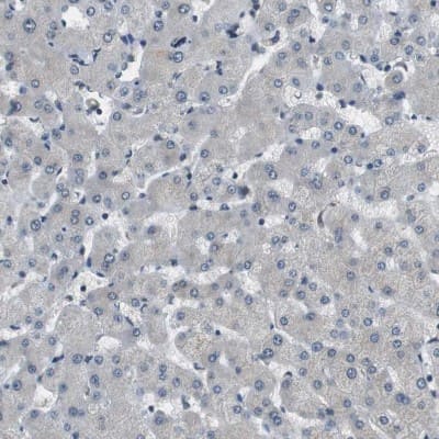 Immunohistochemistry-Paraffin: Paladin Antibody [NBP1-80953]