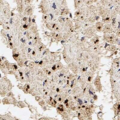 Immunohistochemistry-Paraffin: Palladin Antibody (1E6) - Azide and BSA Free [NBP2-80902]