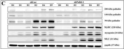 Western Blot: Palladin Antibody (1E6) - Azide and BSA Free [NBP2-80902]