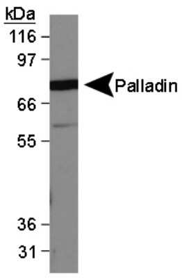 Western Blot: Palladin Antibody (1E6) [NBP1-25959]