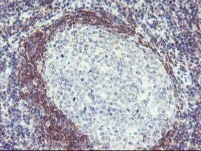 Immunohistochemistry: Pallidin Antibody (OTI1H9) - Azide and BSA Free [NBP2-73233]