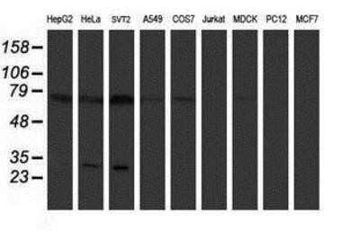 Western Blot: Pallidin Antibody (OTI1H9)Azide and BSA Free [NBP2-73233]