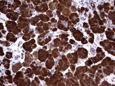Immunohistochemistry: Pancreatic Amylase Alpha Antibody (OTI1E3) [NBP2-46518]