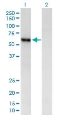 Western Blot: Pancreatic Amylase Beta Antibody [H00000280-B01P]