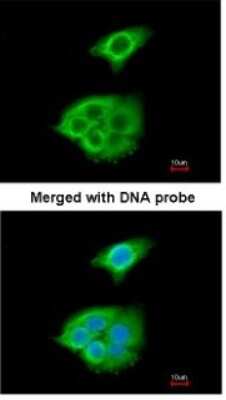 Immunocytochemistry/ Immunofluorescence: Pancreatic Lipase Antibody [NBP1-32789]