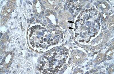 Immunohistochemistry-Paraffin: Pancreatic Lipase Antibody [NBP1-58034]