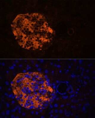 Immunohistochemistry: Pancreatic Lipase Related Protein 2 Antibody - Azide and BSA Free [NBP2-93552]
