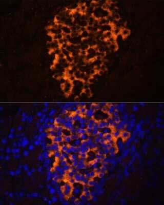 Immunohistochemistry: Pancreatic Lipase Related Protein 2 Antibody - Azide and BSA Free [NBP2-93552]