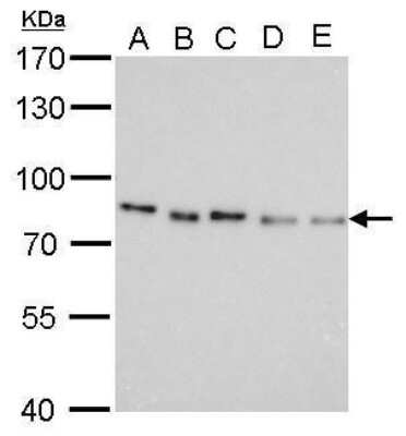 Western Blot: Pancreatic Polypeptide/PP Antibody (1964) [NBP2-43634]