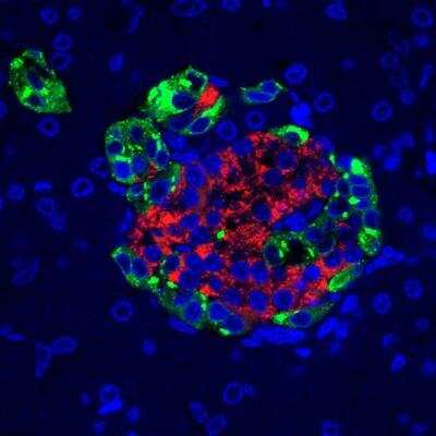 Immunohistochemistry-Paraffin: Pancreatic Polypeptide/PP Antibody [NB100-1793]