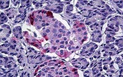 Immunohistochemistry-Paraffin: Pancreatic Polypeptide/PP Antibody [NB100-1793]