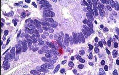 Immunohistochemistry-Paraffin: Pancreatic Polypeptide/PP Antibody [NB100-1793]