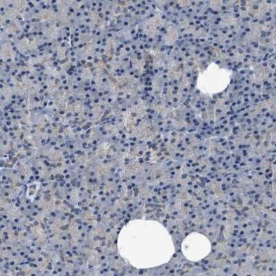 Immunohistochemistry-Paraffin: Pannexin-1 Antibody [NBP1-92241]