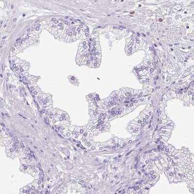 Immunohistochemistry-Paraffin: Pappalysin-2/PAPP-A2 Antibody [NBP1-87340]