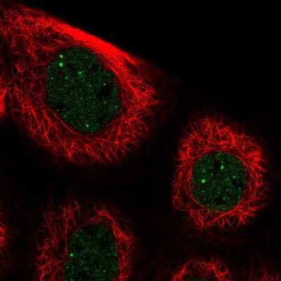 Immunocytochemistry/ Immunofluorescence: Paralemmin 3 Antibody [NBP2-30529]