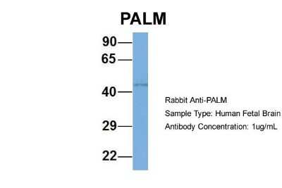 Western Blot: Paralemmin Antibody [NBP1-79624]