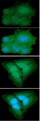 Immunocytochemistry/ Immunofluorescence: Park7/DJ-1 Antibody (1E12) - BSA Free [NBP2-59407]