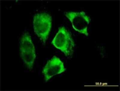Immunocytochemistry/ Immunofluorescence: Parkin Antibody (1H4) [H00005071-M01]