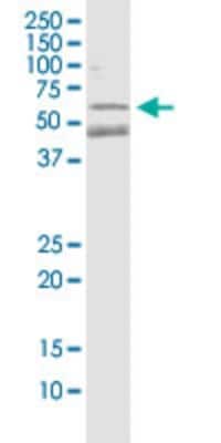 Western Blot: Parkin Antibody (1H4) [H00005071-M01]