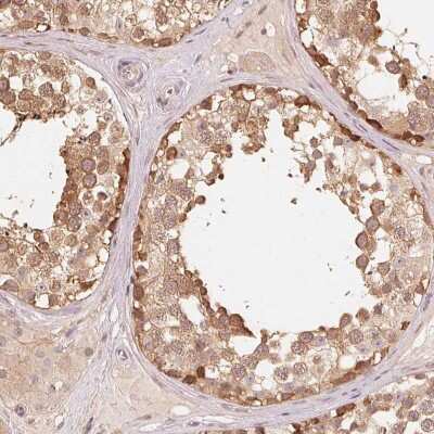 Immunohistochemistry-Paraffin: Parkin Antibody [NBP2-68629]