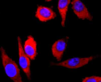 Immunocytochemistry/ Immunofluorescence: Parkin Antibody (JF82-09) [NBP2-67017]