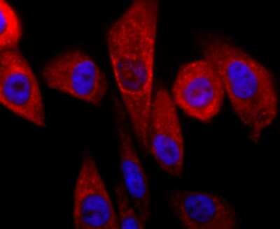 Immunocytochemistry/ Immunofluorescence: Parkin Antibody (JF82-09) [NBP2-67017]