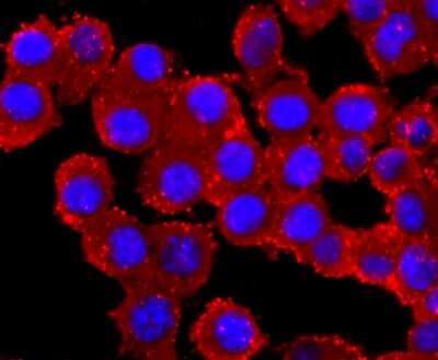 Immunocytochemistry/ Immunofluorescence: Parkin Antibody (JF82-09) [NBP2-67017]