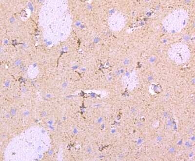 Immunohistochemistry-Paraffin: Parkin Antibody (JF82-09) [NBP2-67017]
