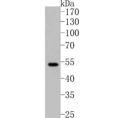 Western Blot: Parkin Antibody (JF82-09) [NBP2-67017]