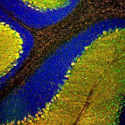 Immunocytochemistry/ Immunofluorescence: Parvalbumin Antibody (3C9) [NBP2-50038]