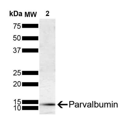 Western Blot: Parvalbumin Antibody (C12) [NBP2-79824]