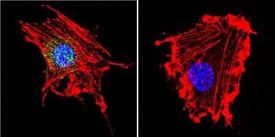 Immunocytochemistry/ Immunofluorescence: Parvalbumin Antibody - BSA Free [NB120-11427]