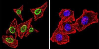 Immunocytochemistry/ Immunofluorescence: Parvalbumin Antibody - BSA Free [NB120-11427]