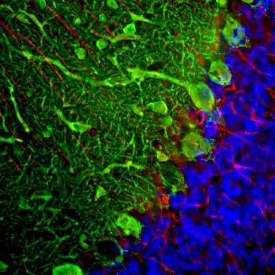 Immunohistochemistry Free-Floating: Parvalbumin Antibody [NBP2-50036]