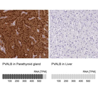 Immunohistochemistry-Paraffin: Parvalbumin Antibody [NBP2-33529]